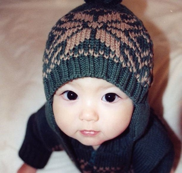 Foto - İri göz bebeklerde o hastalığın habercisi!