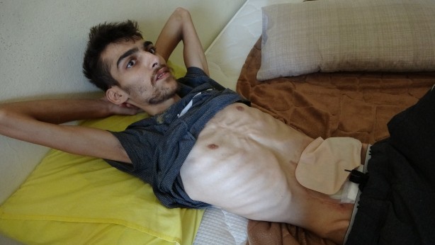 Foto - İş kazası geçirdi 40 kiloya düştü! Suriyeli Muhammed yardım bekliyor