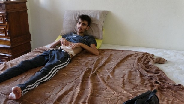 Foto - İş kazası geçirdi 40 kiloya düştü! Suriyeli Muhammed yardım bekliyor