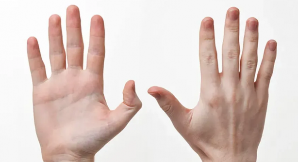 Foto - İşaret parmağı yüzük parmağından kısa olanlar yandı! Hemen elinize bakın! Büyük tehlikenin habercisi