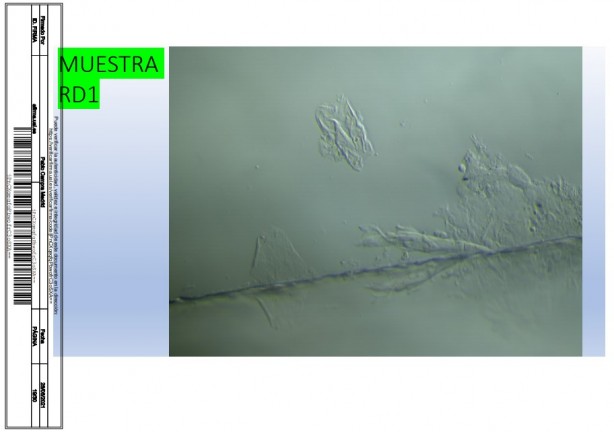 Foto - İspanyol bilim adamı, aşıda grafen tespit etti! Rapor yayınladı