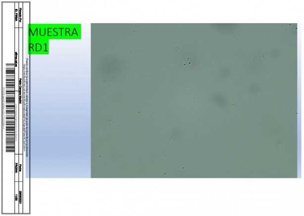 Foto - İspanyol bilim adamı, aşıda grafen tespit etti! Rapor yayınladı