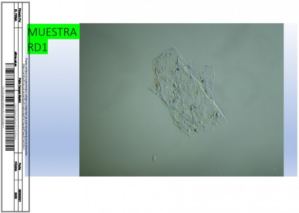 Foto - İspanyol bilim adamı, aşıda grafen tespit etti! Rapor yayınladı