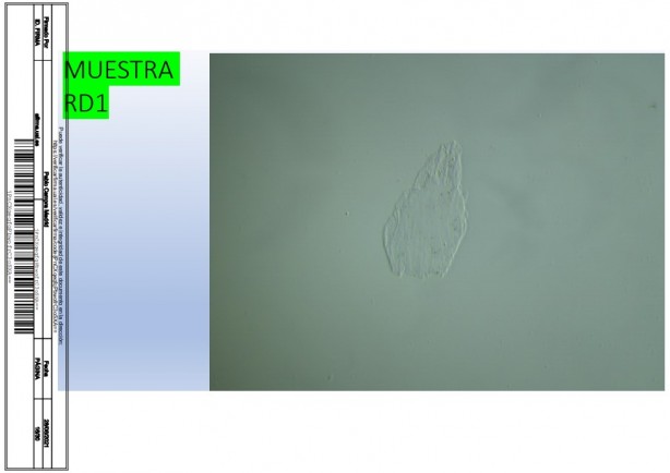 Foto - İspanyol bilim adamı, aşıda grafen tespit etti! Rapor yayınladı