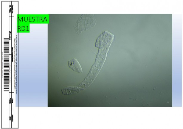Foto - İspanyol bilim adamı, aşıda grafen tespit etti! Rapor yayınladı