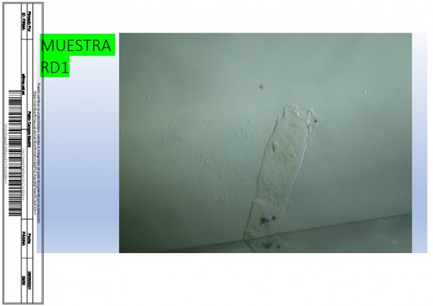 Foto - İspanyol bilim adamı, aşıda grafen tespit etti! Rapor yayınladı