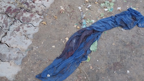 Foto - İsrail vahşetinin boyutu gün ağarınca ortaya çıktı! İşte katliamın yaşandığı hastaneden geriye kalanlar...