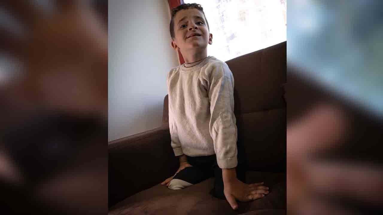 Foto - İsrail vurdu, Türkiye kurtardı: Minik Filistinlinin yürek burkan hikayesi
