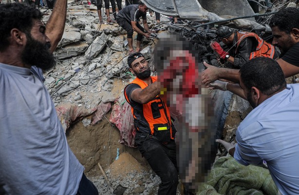 Foto - İsrail'in saldırıları sonucu bir gecede 80 kişi şehid oldu!