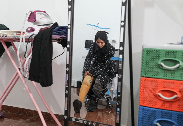 İsrail'in saldırılarında bacağını kaybeden Filistinli kadın hayat mücadelesini sürdürüyor