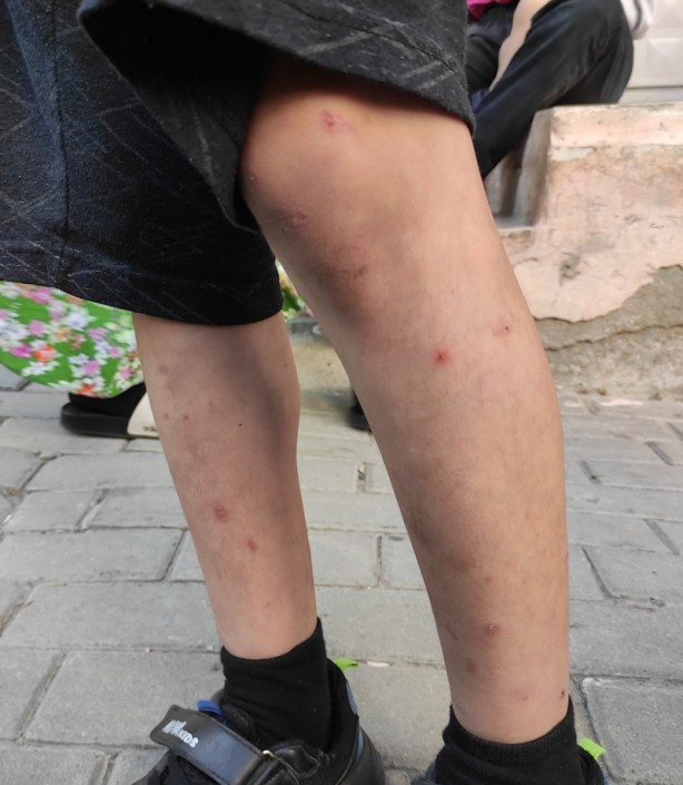 Foto - İstanbul'da sivrisineklerin görülme sıklığında artış