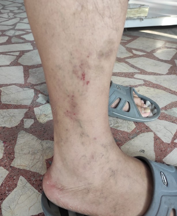 Foto - İstanbul'da sivrisineklerin görülme sıklığında artış