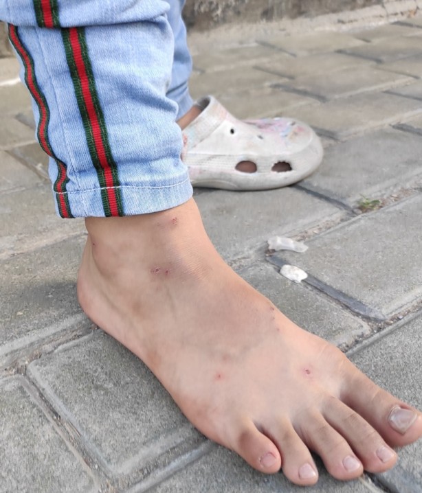 Foto - İstanbul'da sivrisineklerin görülme sıklığında artış