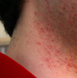 Foto - İstasyonda benzin alanlar dikkat! Bu detaylar çok konuşulur