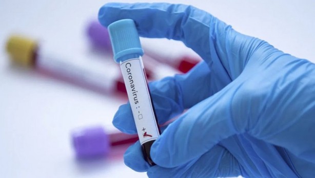 Foto - İşte ABD, İtalya, İspanya, İngiltere ve Rusya'nın koronavirüs tablosu!