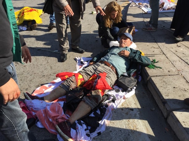 Foto - İşte Ankara'daki patlamadan ilk görüntüler!