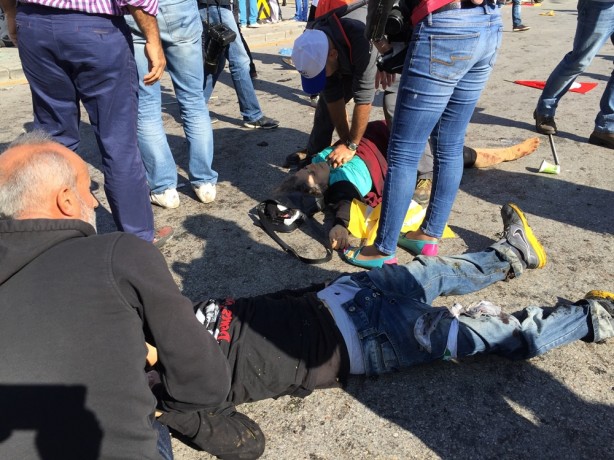 Foto - İşte Ankara'daki patlamadan ilk görüntüler!