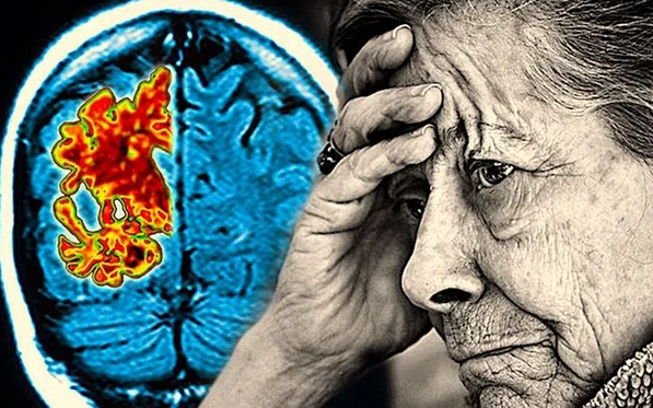 Foto - İşte araştırmanın korkutan sonuçları! Eğer sürekli duraklayıp kalemi sarsıntılı kullanıyorsanız...