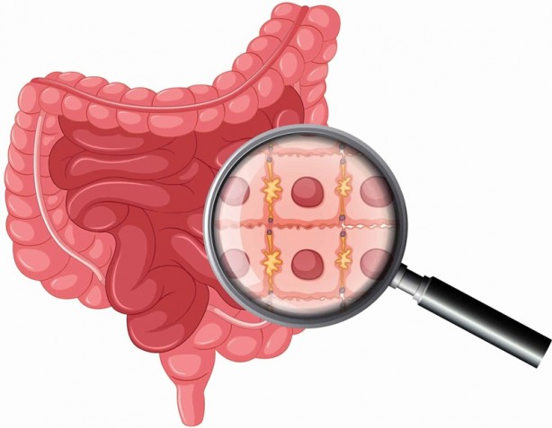 Foto - İşte bağırsaklarınızın sağlıksız olduğunu gösteren 6 belirti!