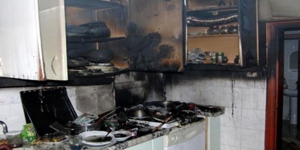 Foto - İşte birbirinden korkunç mutfak kazaları