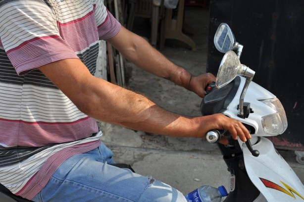 Foto - İşte çift kol nakli yapılan Cihan Topal