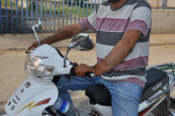 Foto - İşte çift kol nakli yapılan Cihan Topal