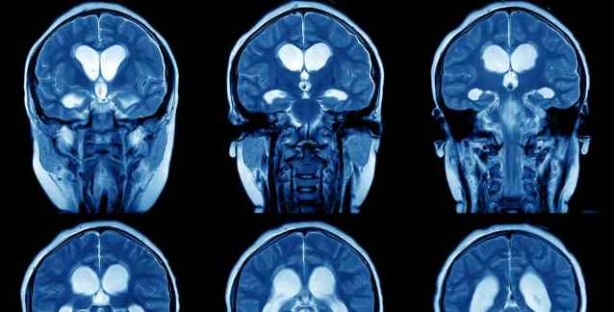 Foto - İşte daha zeki olmanın yolları!