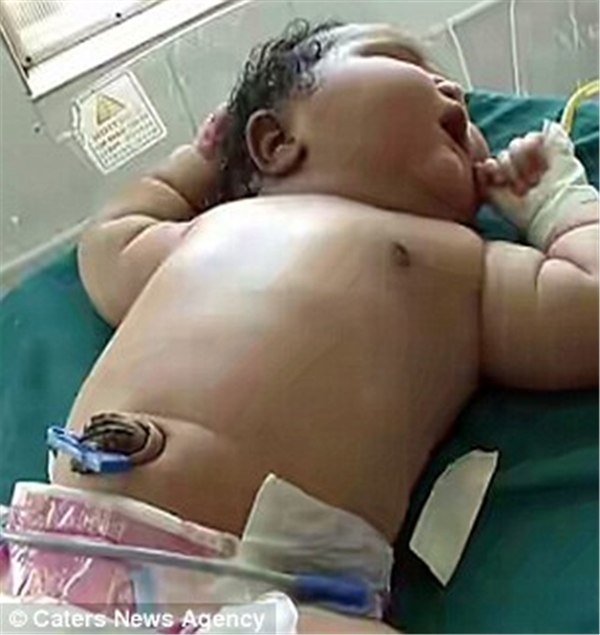 Foto - İşte dünyanın en ağır bebeği