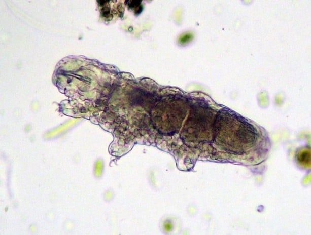 Foto - İşte dünyanın en dayanıklı canlısı!