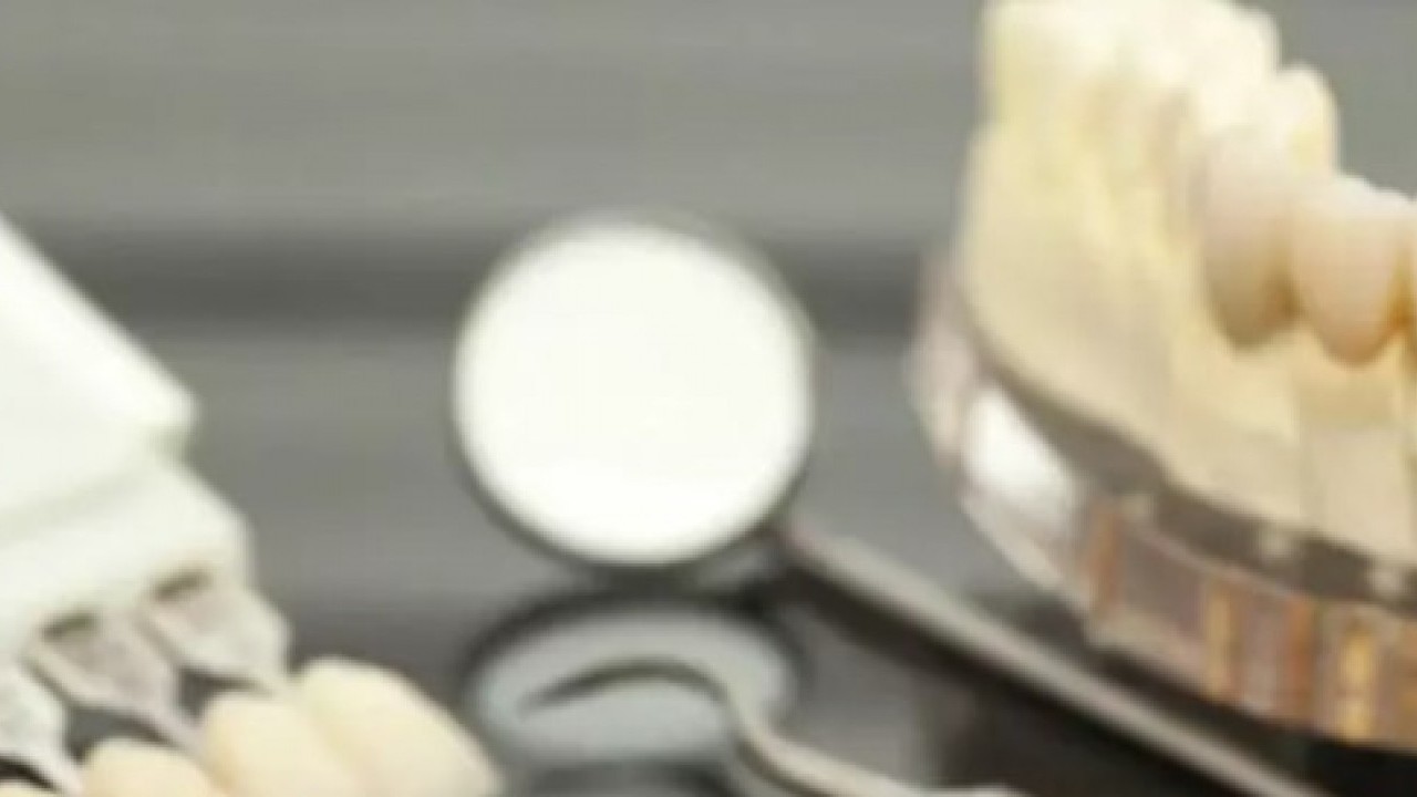 Foto - İşte en çok dişçiye giden ülkeler! Türkiye ters köşe yaptı!