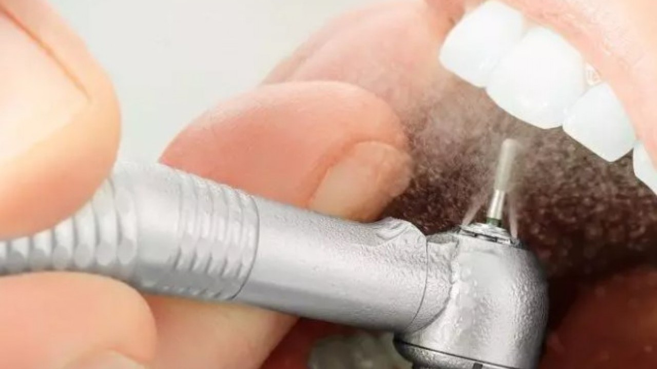 Foto - İşte en çok dişçiye giden ülkeler! Türkiye ters köşe yaptı!