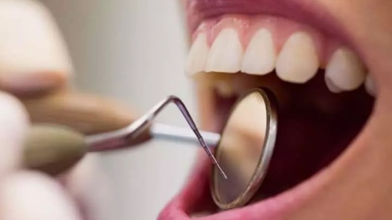 Foto - İşte en çok dişçiye giden ülkeler! Türkiye ters köşe yaptı!