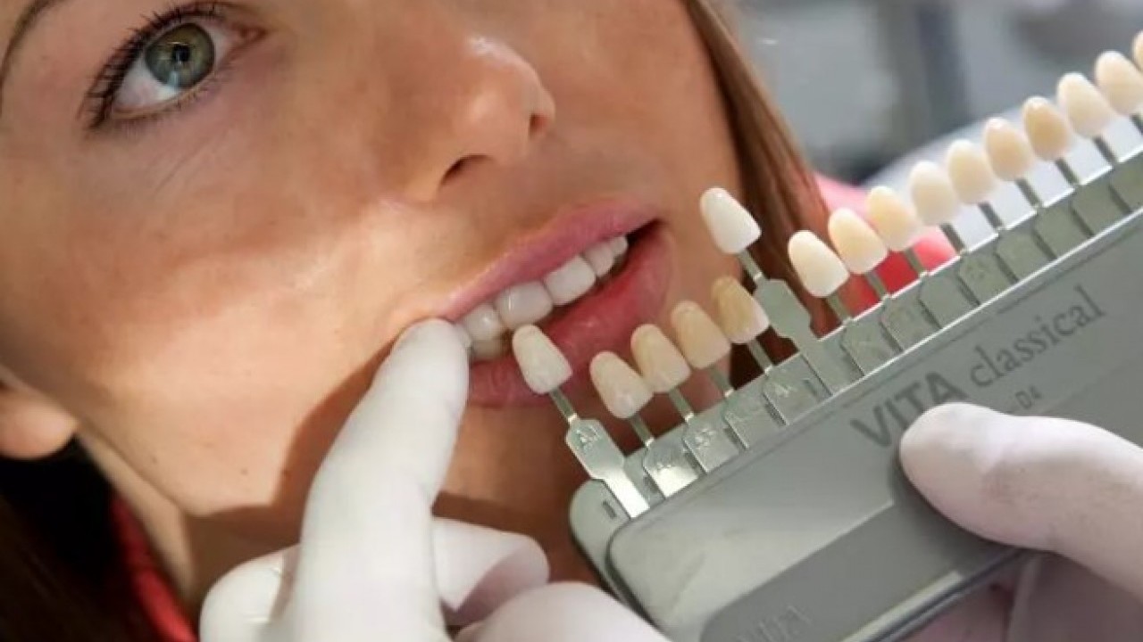 Foto - İşte en çok dişçiye giden ülkeler! Türkiye ters köşe yaptı!