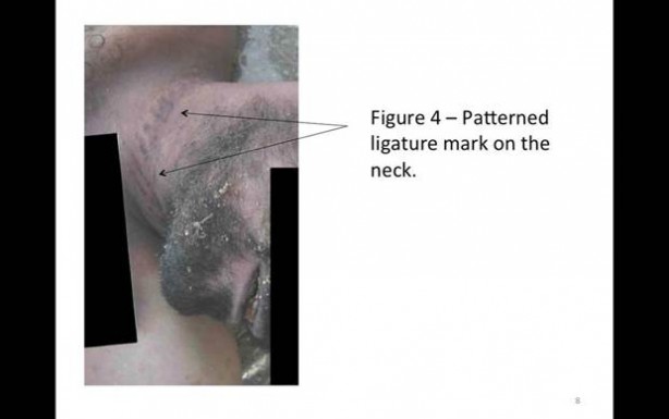 Foto - Esed katliamı kanıtlandı!