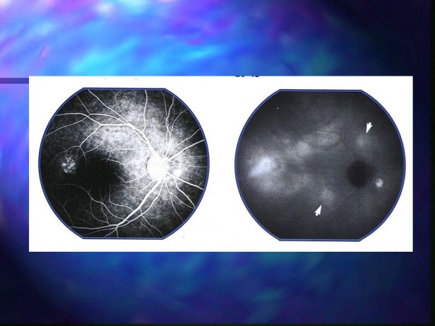 Foto - İşte göz sağlığını korumanın 8 yolu