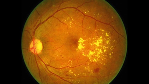 Foto - İşte göz sağlığını korumanın 8 yolu