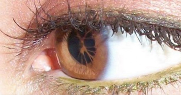 Foto - İşte göz sağlığını korumanın 8 yolu