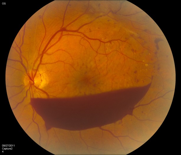 Foto - İşte göz sağlığını korumanın 8 yolu
