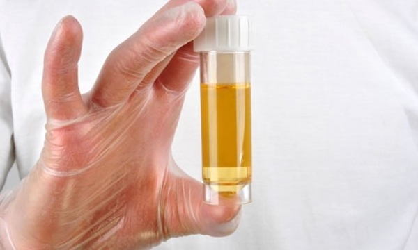 Foto - İşte kanserin belirtileri