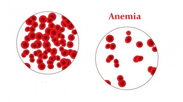 Foto - İşte kulak çınlamasının 10 nedeni