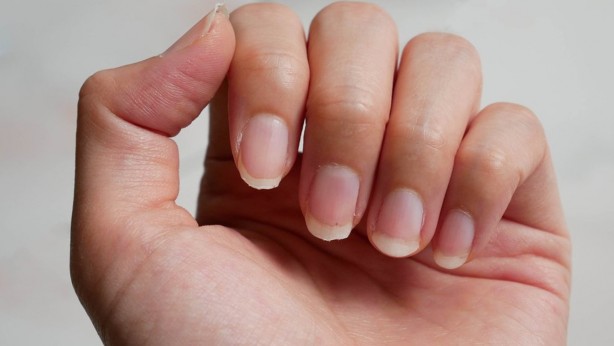 Foto - İşte o gıdalar Cilt, saç ve tırnak sağlığınıza bire bir