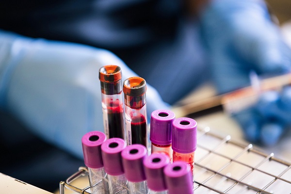 İşte, o liste! Hangi kan grubu hangi besinleri tüketmeli?