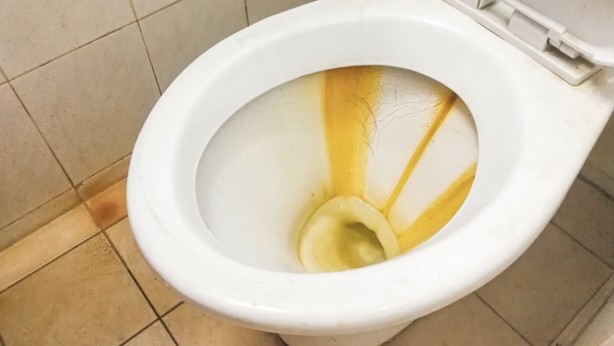 Foto - İşte sararmış klozetleri kar beyazına çeviren yöntem! Sadece bu iki malzemeye ihtiyacınız var! Anında kökünü kazıyor