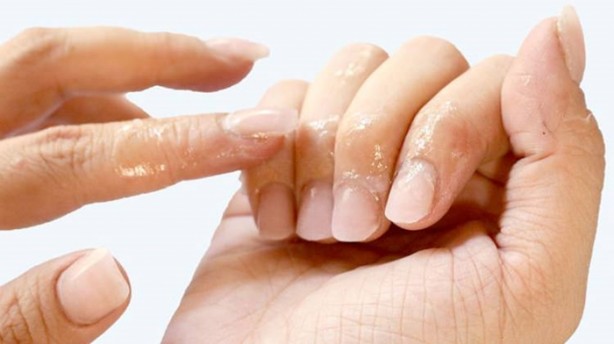 Foto - İşte tırnaklardaki beyaz lekelerin sebebi!