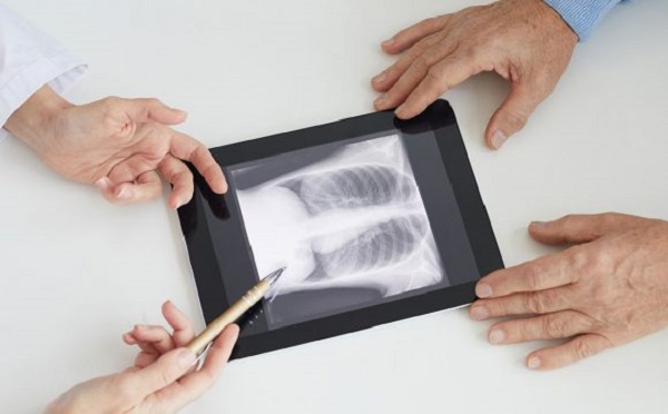 Foto - İşte, zatürre belirtileri! 