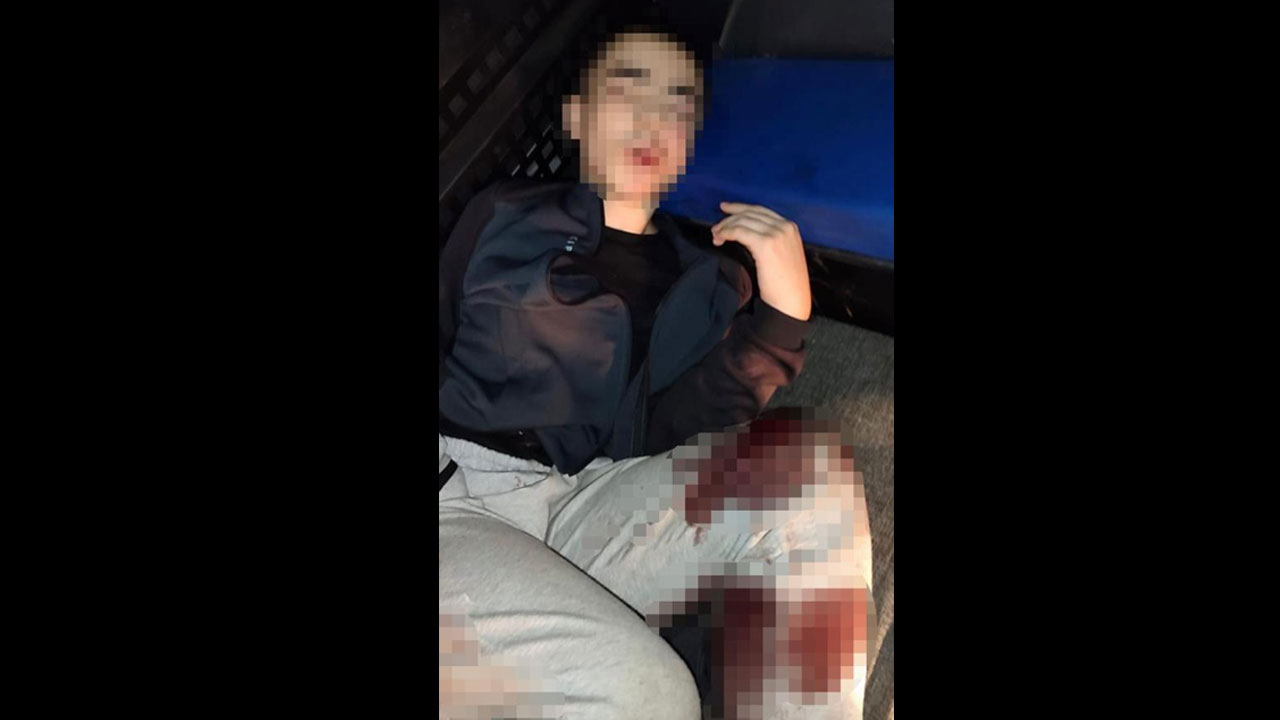 İzmir’de karakola saldıran velet yaralı yakalandı! İşte polis katilinin görüntüsü