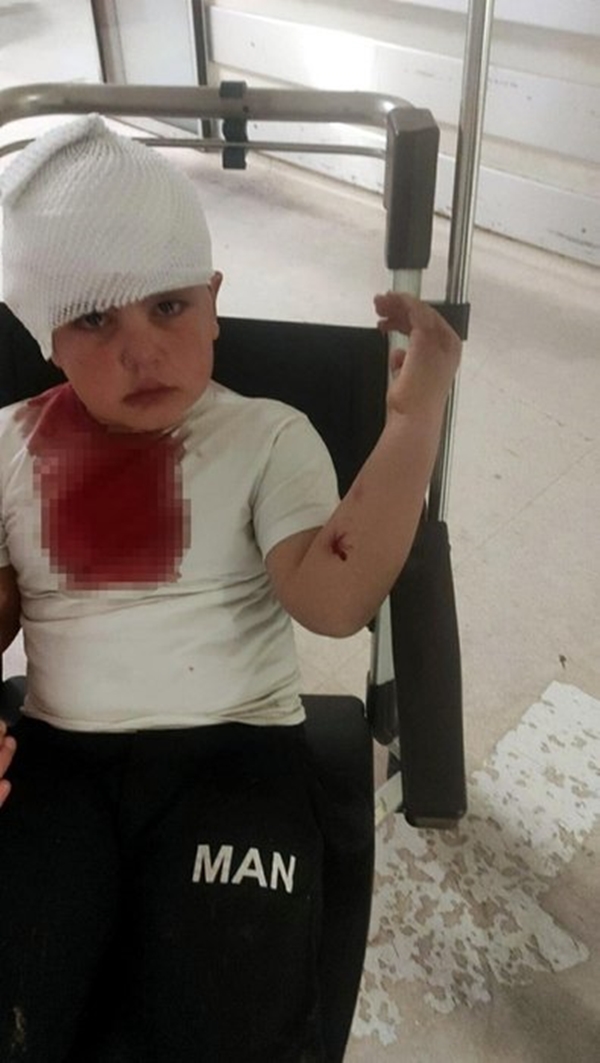 Foto - İzmir'de pitbull dehşeti... Minik Çınar'ın bir anda üzerine atladı