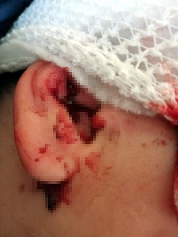 Foto - İzmir'de pitbull dehşeti... Minik Çınar'ın bir anda üzerine atladı