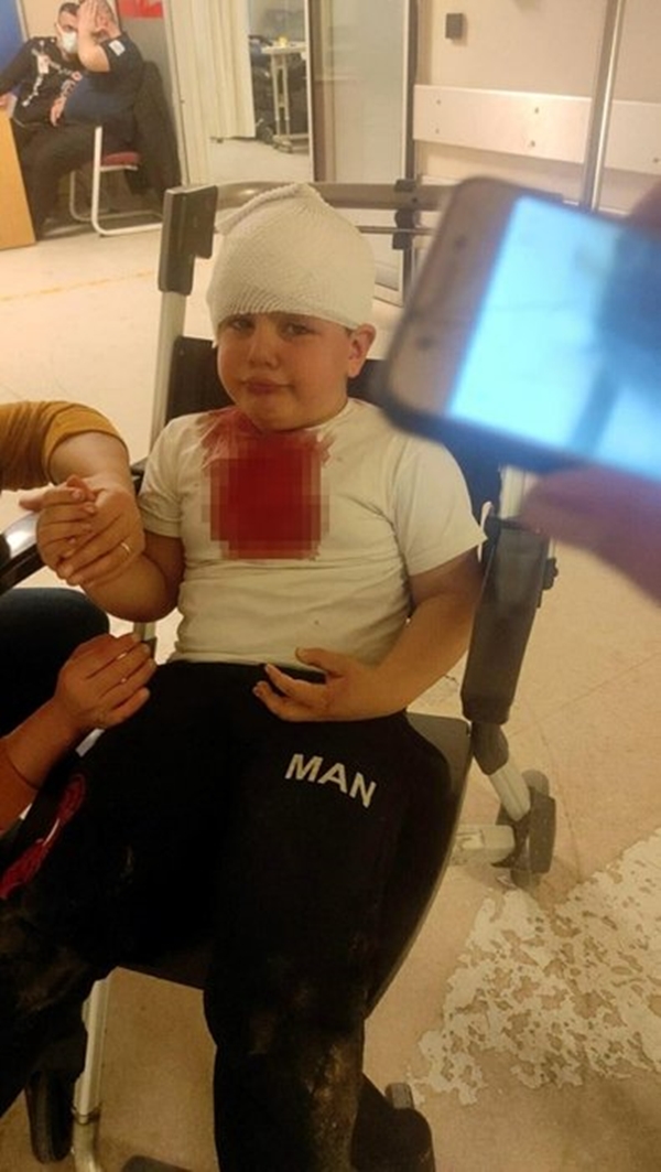 Foto - İzmir'de pitbull dehşeti... Minik Çınar'ın bir anda üzerine atladı