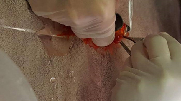 Foto - Japon balığını ameliyata aldılar!